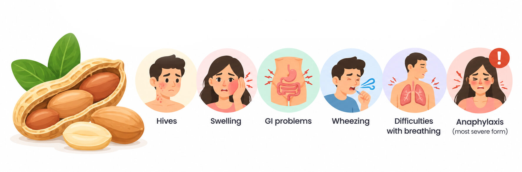 Peanut allergy symptoms from mild to severe