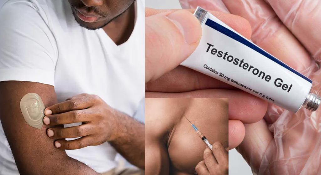 Testosterone replacement therapy options for men