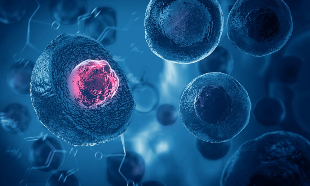 Stem Cell Therapy